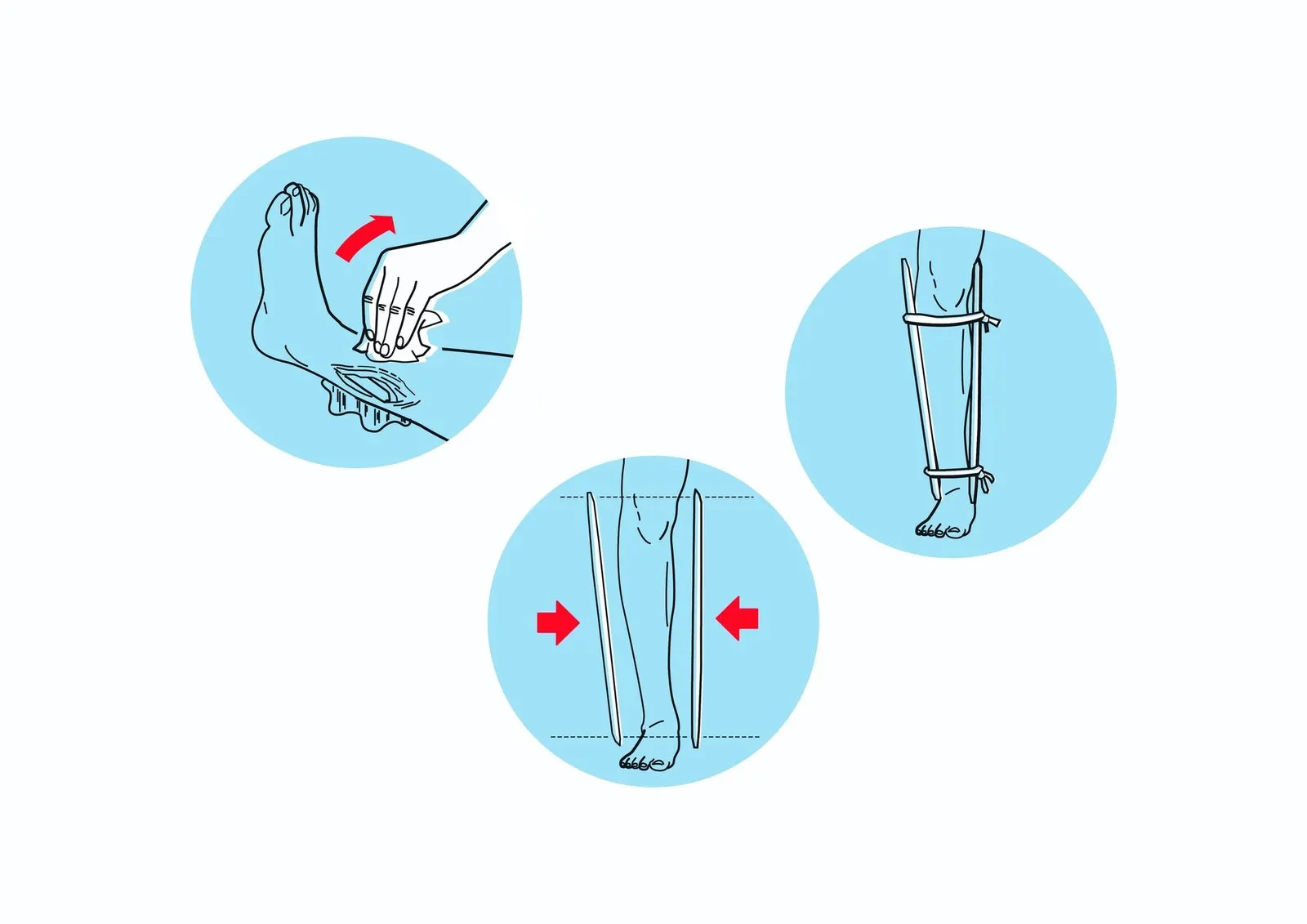 How to Make a Splint