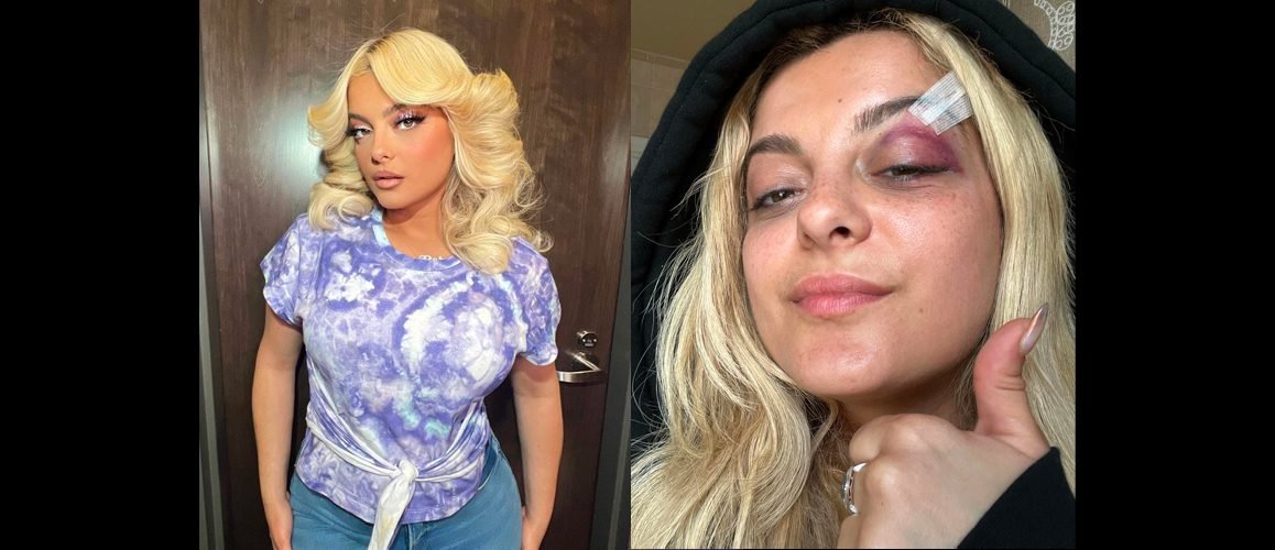 Pop Singer Bebe Rexha Hit On The Face During NYC Concert